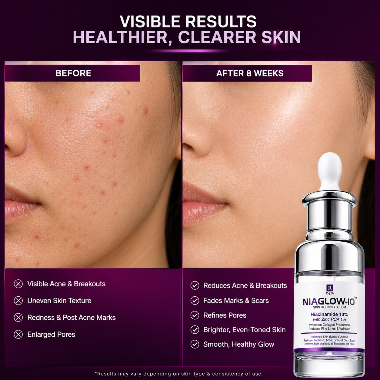 NIAGLOW-I0 Oil Control & Acne Care Niacinamide Serum